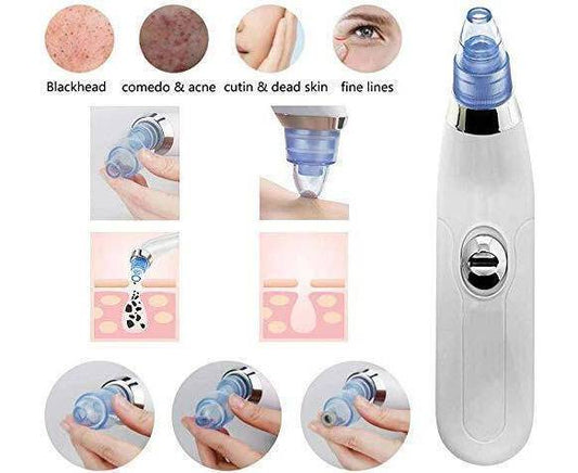 Blackhead Suction Remover